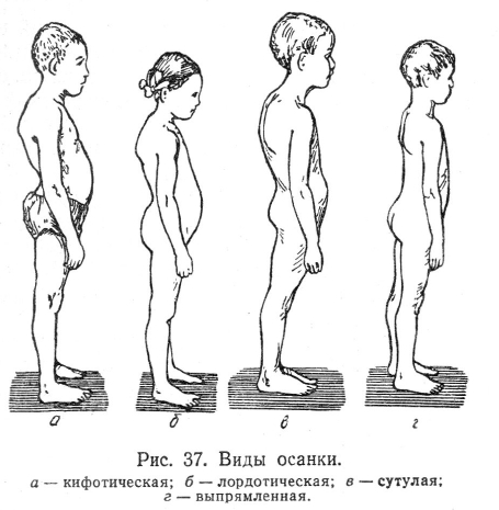 Виды осанки